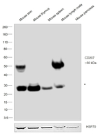 CD207 (Langerin) Antibody in Western Blot (WB)
