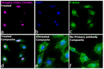 Phospho-CHK2 (Thr68) Antibody