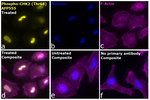 Phospho-CHK2 (Thr68) Antibody