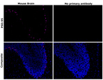 PSD-95 Recombinant Mouse Monoclonal Antibody (7E3-1B8)
