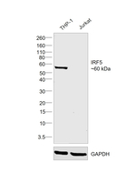 IRF5 Recombinant Mouse Monoclonal Antibody (ALYSCLN)