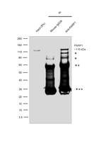 PARP1 Antibody in Immunoprecipitation (IP)