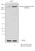 Phospho-mTOR (Ser2448) Recombinant Mouse Monoclonal Antibody (MRRBY)