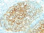 CD106/VCAM1 (Activated Endothelial Cell Marker) Monoclonal Antibody (1.4C3)