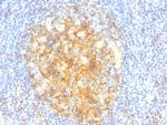 CD106/VCAM1 Monoclonal Antibody (VCAM1, 843)