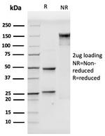 CD106/VCAM1 (Activated Endothelial Cell Marker) Antibody in SDS-PAGE (SDS-PAGE)