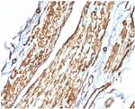 Vinculin (Marker of Age-related Macular Degeneration) Monoclonal Antibody (VCL/2575)