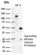 Vinculin (Marker of Age-related Macular Degeneration) Antibody in Immunoelectrophoresis (IE)