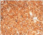 Vinculin (Marker of Age-related Macular Degeneration) Antibody in Immunohistochemistry (Paraffin) (IHC (P))