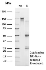 VEGF-A (Vascular Endothelial Growth Factor) Antibody in SDS-PAGE (SDS-PAGE)