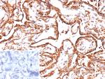 VEGF-A (Vascular Endothelial Growth Factor) Antibody in Immunohistochemistry (Paraffin) (IHC (P))