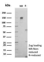 VEGF-A (Vascular Endothelial Growth Factor) Antibody in SDS-PAGE (SDS-PAGE)