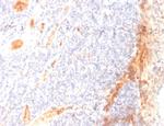 VEGF (Vascular Endothelial Growth Factor) Monoclonal Antibody (VG1)