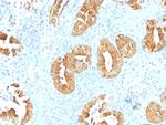 Villin (GI-Mucosal and Urogenital Brush Border Marker) Monoclonal Antibody (VIL1/1314)
