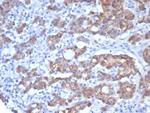 Villin (GI-Mucosal and Urogenital Brush Border Marker) Recombinant Mouse Monoclonal Antibody (rVIL1/8336)