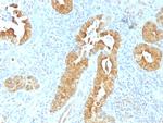 Villin (GI-Mucosal and Urogenital Brush Border Marker) Monoclonal Antibody (VIL1/1325)