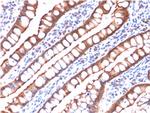 Villin (GI-Mucosal and Urogenital Brush Border Marker) Monoclonal Antibody (rVIL1/1325)