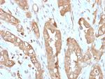 Villin (GI-Mucosal and Urogenital Brush Border Marker) Recombinant Rabbit Monoclonal Antibody (VIL1/2310R)