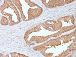 Ezrin/p81 Monoclonal Antibody (CPTC-Ezrin-1)