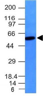 Vimentin (Mesenchymal Cell Marker) Antibody in Western Blot (WB)