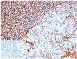 Vimentin (Mesenchymal Cell Marker) Antibody in Immunohistochemistry (Paraffin) (IHC (P))