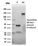 Vimentin (Mesenchymal Cell Marker) Antibody in SDS-PAGE (SDS-PAGE)