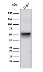 Vimentin (Mesenchymal Cell Marker) Antibody in Western Blot (WB)