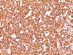 Vimentin (Mesenchymal Cell Marker) Antibody in Immunohistochemistry (Paraffin) (IHC (P))
