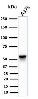 Vimentin (Mesenchymal Cell Marker) Antibody in Western Blot (WB)
