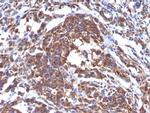 Vimentin (Mesenchymal Cell Marker) Antibody in Immunohistochemistry (Paraffin) (IHC (P))
