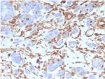 Vimentin Antibody in Immunohistochemistry (Paraffin) (IHC (P))