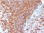 Vimentin Antibody in Immunohistochemistry (Paraffin) (IHC (P))