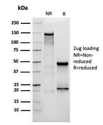 Vimentin Antibody in SDS-PAGE (SDS-PAGE)