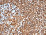 Vimentin Antibody in Immunohistochemistry (Paraffin) (IHC (P))