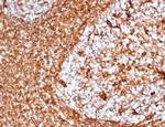 Vimentin (Mesenchymal Cell Marker) Recombinant Rabbit Monoclonal Antibody (VIM/6576R)