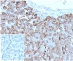 VLDL-Receptor (Very Low Density Lipoprotein Receptor) Monoclonal Antibody (rVLDLR/1337)
