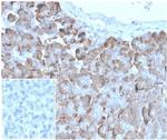 VLDL-Receptor (Very Low Density Lipoprotein Receptor) Recombinant Mouse Monoclonal Antibody (rVLDLR/1337)