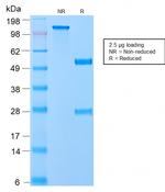 VLDL-Receptor (Very Low Density Lipoprotein Receptor) Recombinant Rabbit Monoclonal Antibody (VLDLR/2896R)