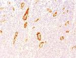 von Willebrand Factor/Factor VIII Related-Ag (Endothelial Marker) Antibody in Immunohistochemistry (Paraffin) (IHC (P))
