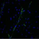 von Willebrand Factor/Factor VIII Related-Ag (Endothelial Marker) Monoclonal Antibody (3E2D10)