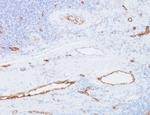 von Willebrand Factor/Factor VIII Related-Ag (Endothelial Marker) Antibody in Immunohistochemistry (Paraffin) (IHC (P))