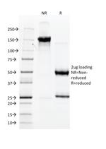von Willebrand Factor/Factor VIII Related-Ag (Endothelial Marker) Antibody in SDS-PAGE (SDS-PAGE)