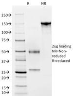 von Willebrand Factor/Factor VIII Related-Ag (Endothelial Marker) Antibody in SDS-PAGE (SDS-PAGE)