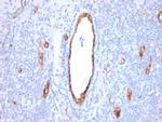 von Willebrand Factor/Factor VIII Related-Ag (Endothelial Marker) Antibody in Immunohistochemistry (Paraffin) (IHC (P))