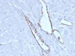 von Willebrand Factor/Factor VIII Related-Ag (Endothelial Marker) Monoclonal Antibody (VWF/4106)