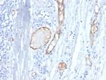 von Willebrand Factor/Factor VIII Related-Ag (Endothelial Marker) Antibody in Immunohistochemistry (Paraffin) (IHC (P))