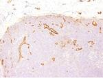 von Willebrand Factor/Factor VIII Related-Ag (Endothelial Marker) Antibody in Immunohistochemistry (Paraffin) (IHC (P))