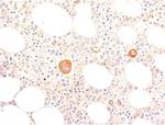 von Willebrand Factor/Factor VIII Related-Ag (Endothelial Marker) Antibody in Immunohistochemistry (Paraffin) (IHC (P))