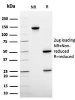 von Willebrand Factor/Factor VIII Related-Ag (Endothelial Marker) Antibody in SDS-PAGE (SDS-PAGE)