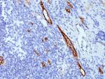 von Willebrand Factor/Factor VIII Related-Ag (Endothelial Marker) Antibody in Immunohistochemistry (Paraffin) (IHC (P))